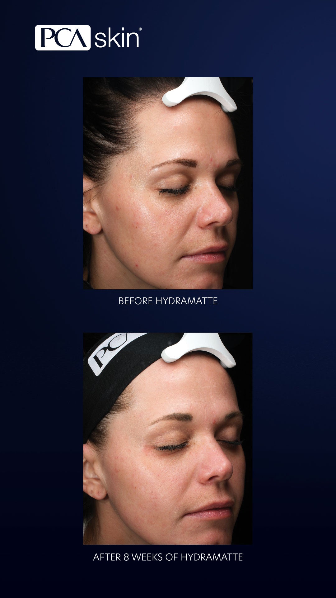 PCA Skin HydraMatte