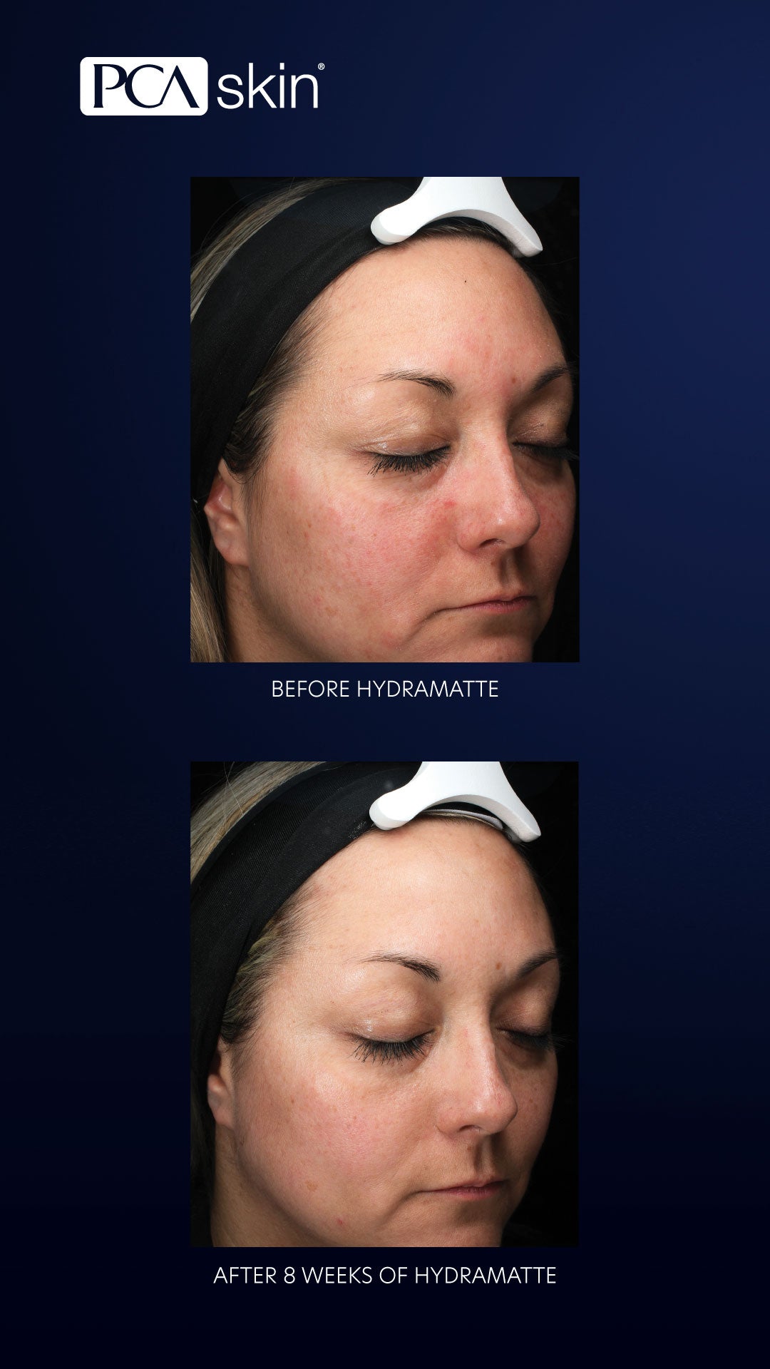 PCA Skin HydraMatte