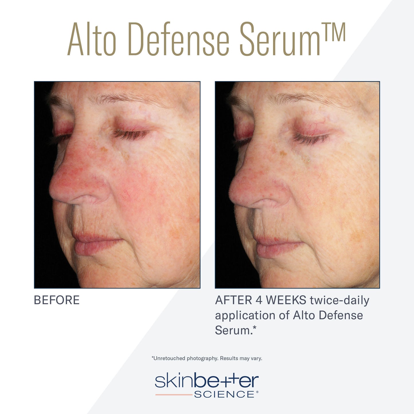 SKIN BETTER SCIENCE - Alto Defense Serum