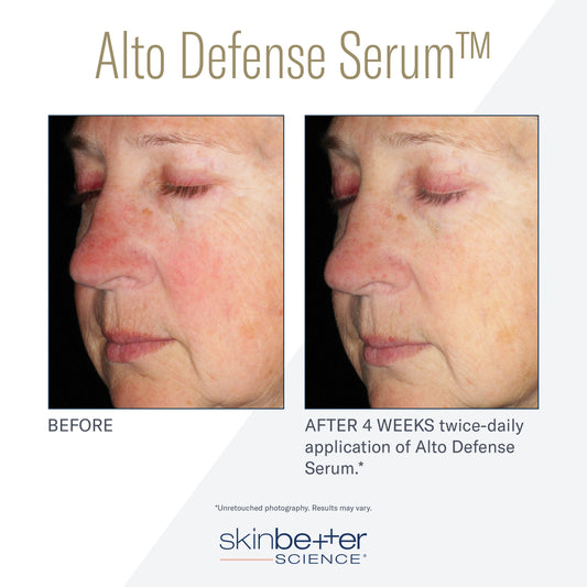 SKIN BETTER SCIENCE - Alto Defense Serum