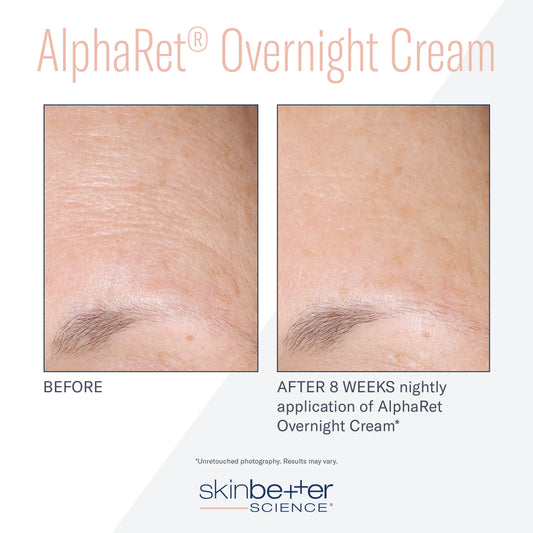 SKIN BETTER SCIENCE - AlphaRet Overnight Cream Face