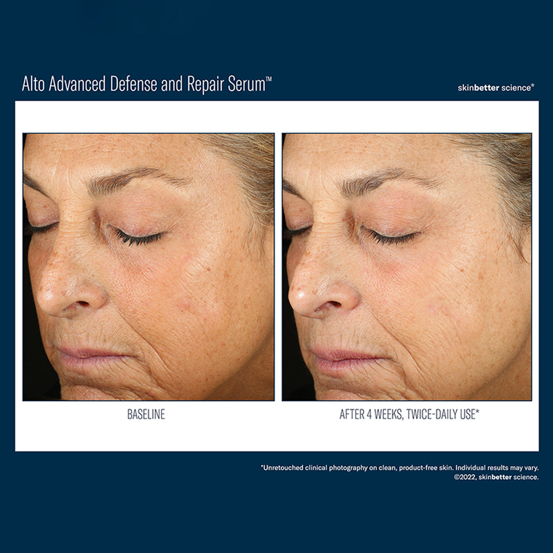 SKIN BETTER SCIENCE - Alto Advanced Defense & Repair Serum