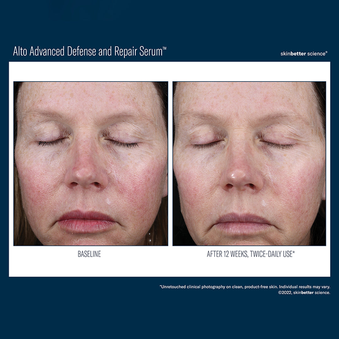 SKIN BETTER SCIENCE - Alto Advanced Defense & Repair Serum