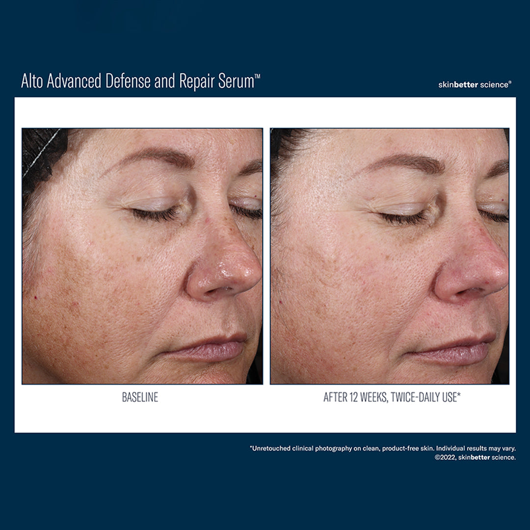 SKIN BETTER SCIENCE - Alto Advanced Defense & Repair Serum