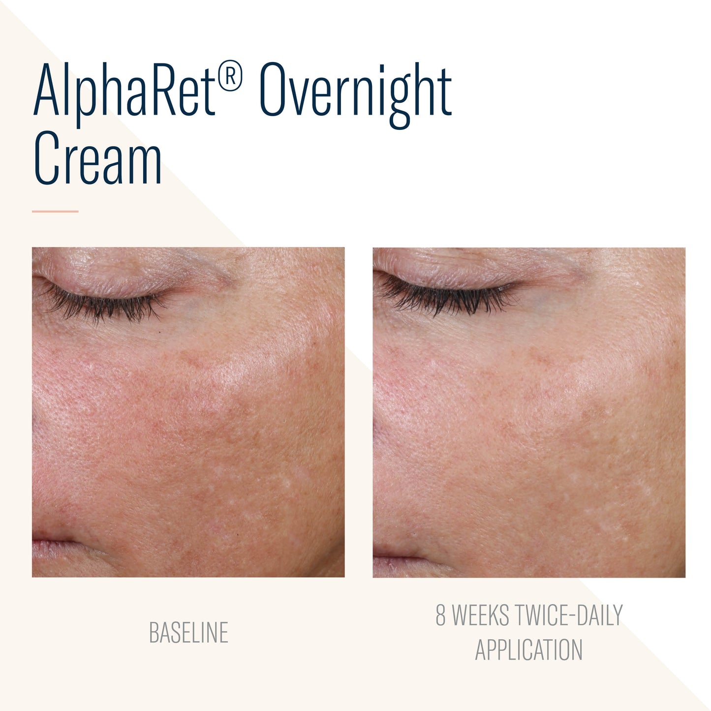 SKIN BETTER SCIENCE - AlphaRet Overnight Cream Face