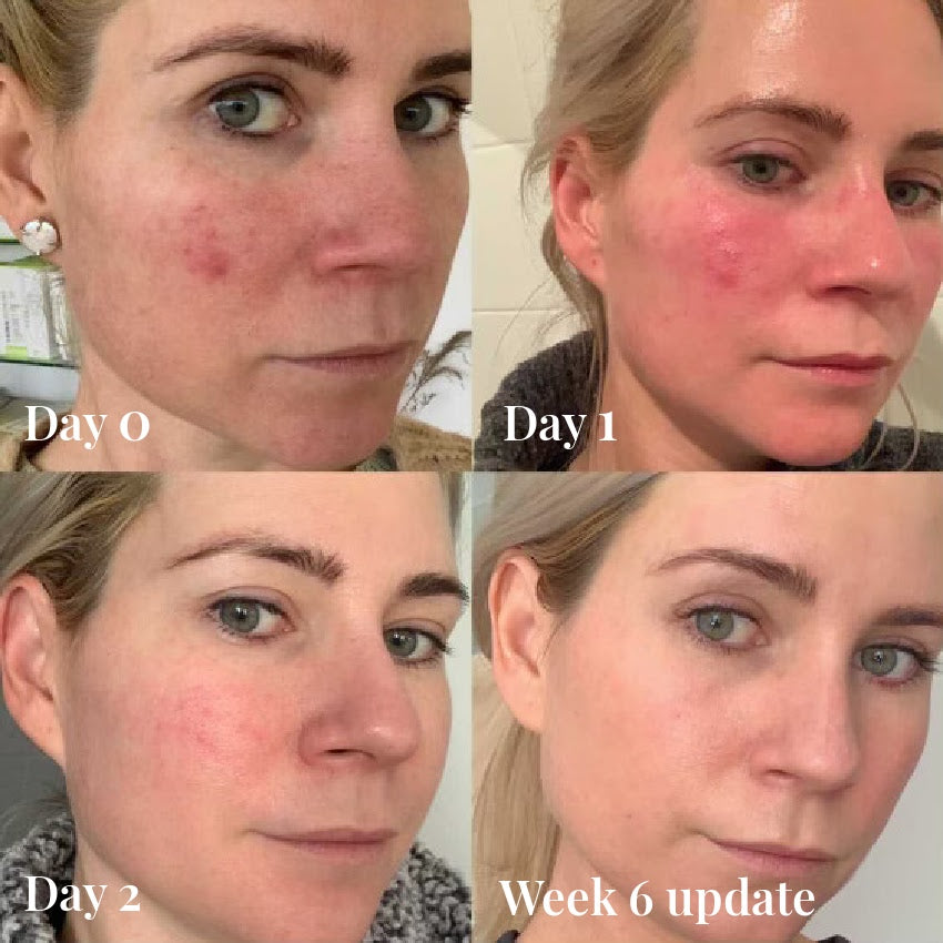 OMNILUX Contour LED Mask