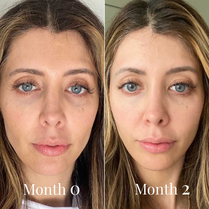 OMNILUX Contour LED Mask