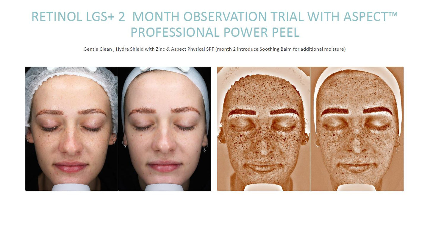 ASPECT Retinol LGS+