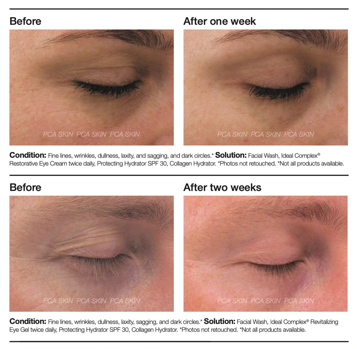 PCA Skin Ideal complex restorative eye cream
