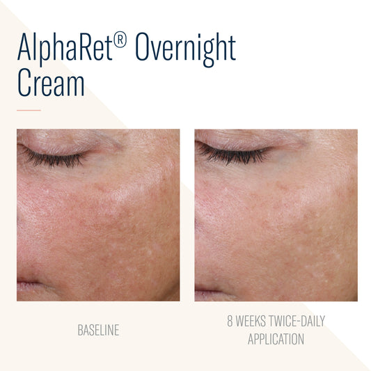 SKIN BETTER SCIENCE - AlphaRet Intensive Overnight Cream