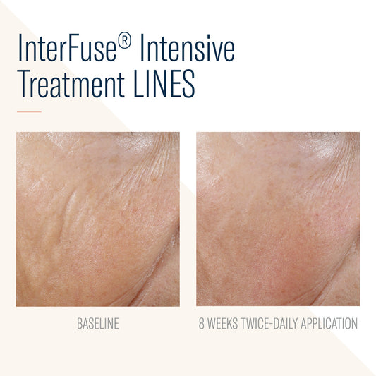 SKIN BETTER SCIENCE - Interfuse Intense Treatment Lines
