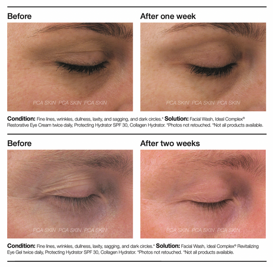 PCA Skin Ideal complex restorative eye cream